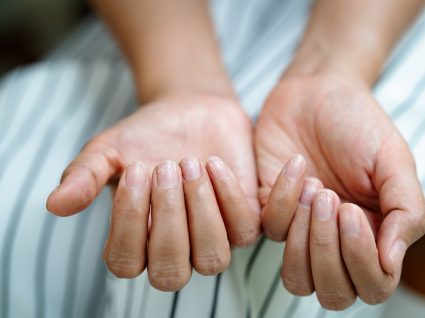 O que dizem as unhas sobre a sua saúde