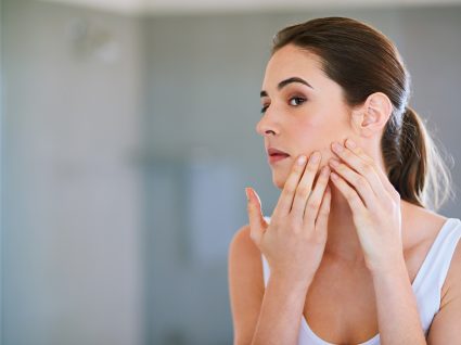 Acne: 5 cremes para os diferentes tipos de pele