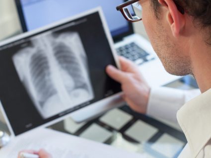 Enfisema pulmonar: causas, sintomas e tratamento