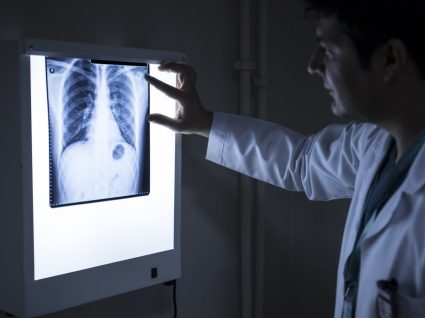 Carcinoma: o que é e principais características