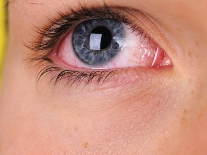 Olhos secos: saiba o que fazer