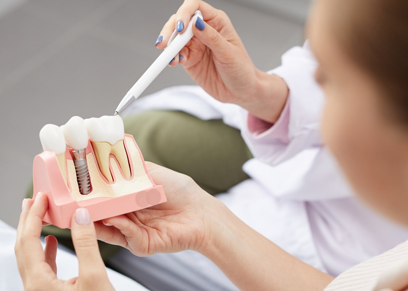 dentista com maquete de implante dentário